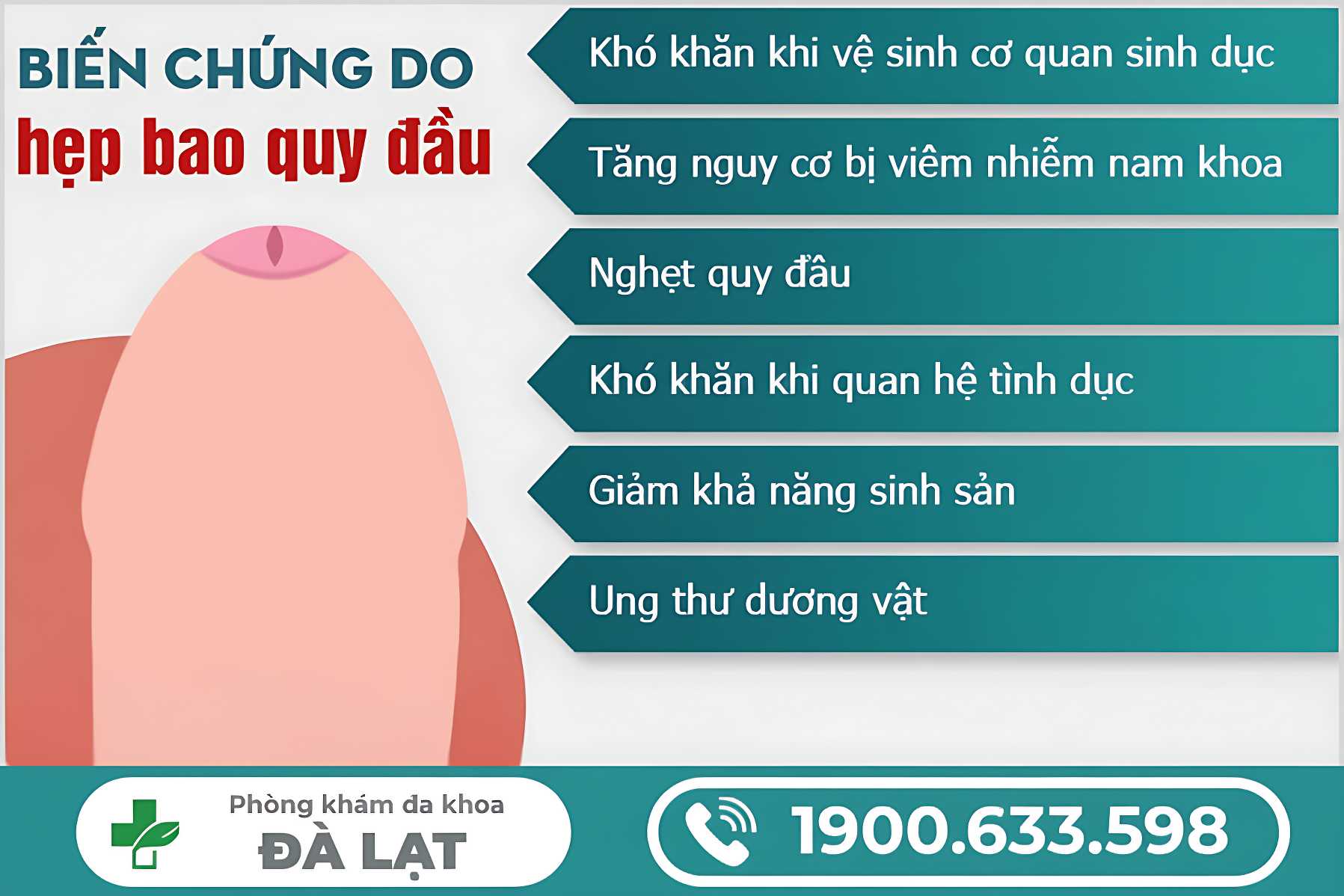 Hình ảnh minh họa